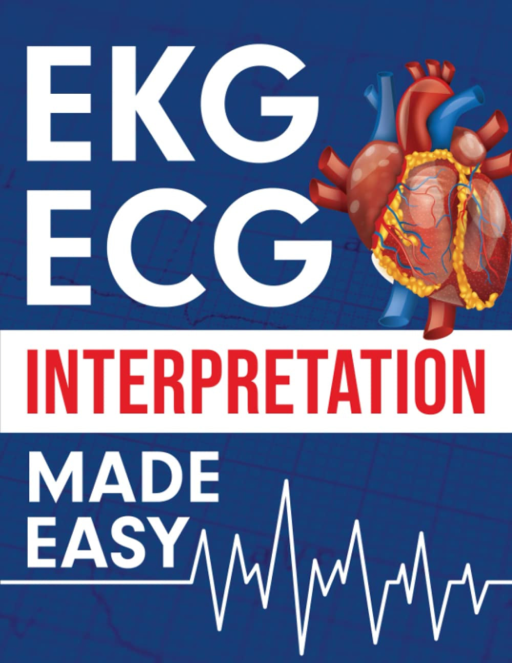 EKG and ECG Interpretation Made Easy — illustrated study guide to reading and interpreting ECG strips